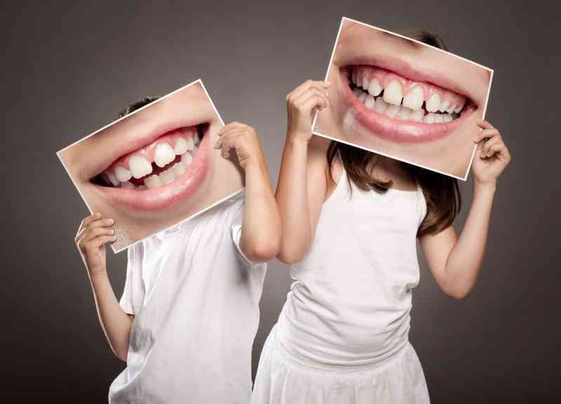 Denti dritti, deglutizione e linguaggio nei bambini